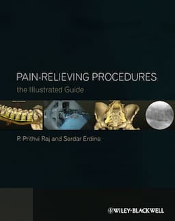 Pain-Relieving Procedures: The Illustrated Guide