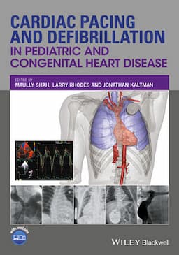 Cardiac Pacing and Defibrillation in Pediatric and Congenital Heart Disease