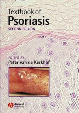 Textbook of Psoriasis, 2nd Edition