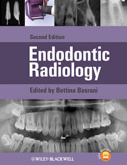 Endodontic Radiology, 2nd Edition