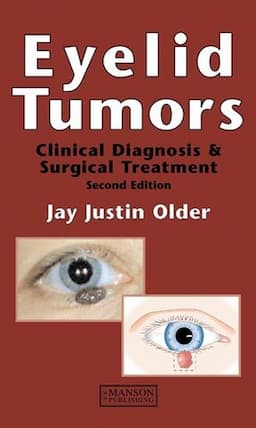 Eyelid Tumours, 2nd Edition